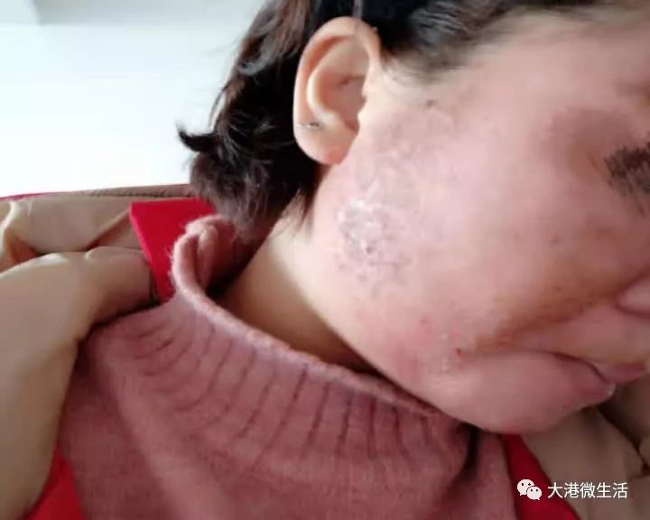 最新寶顏術(shù)，探索美容新境界的奧秘